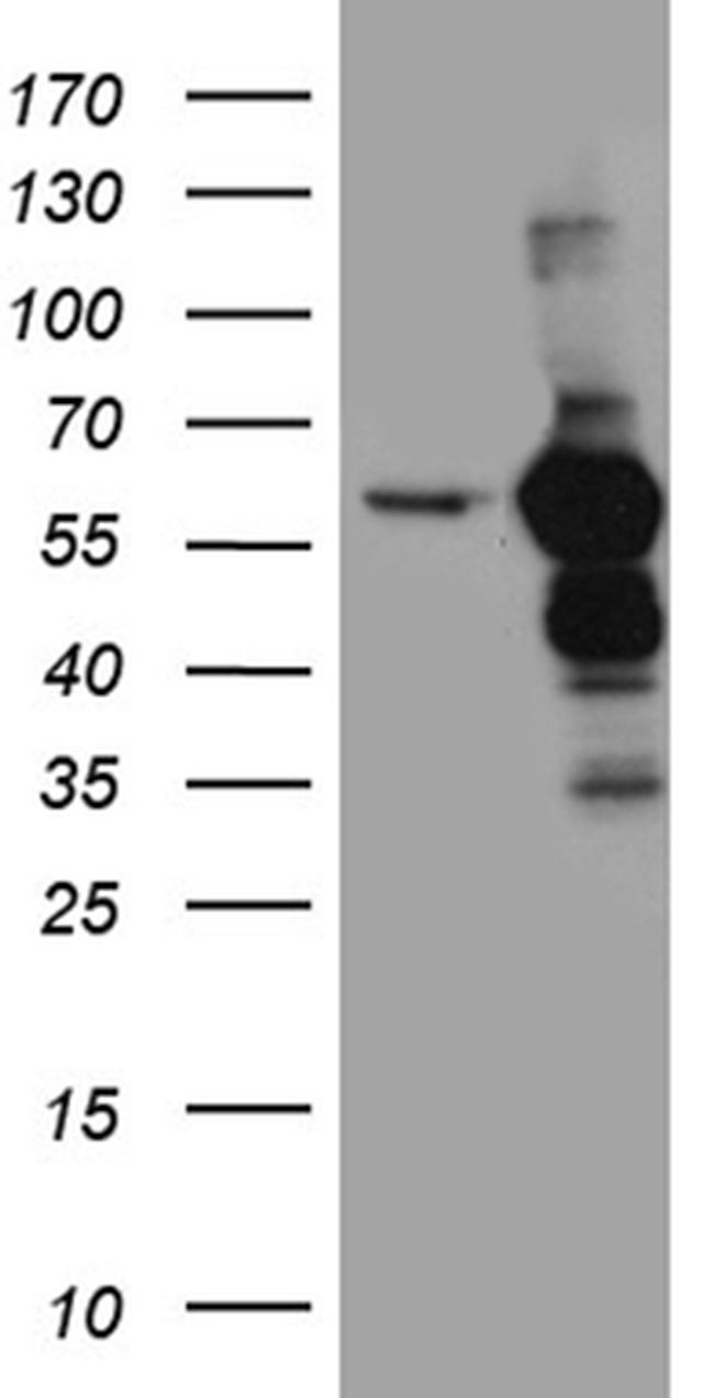 TXNRD1 Antibody in Western Blot (WB)