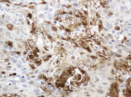 TYMP Antibody in Immunohistochemistry (Paraffin) (IHC (P))