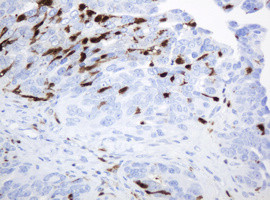 TYMP Antibody in Immunohistochemistry (Paraffin) (IHC (P))