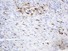 TYMP Antibody in Immunohistochemistry (Paraffin) (IHC (P))