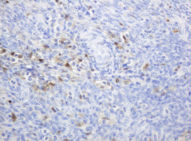 TYMP Antibody in Immunohistochemistry (Paraffin) (IHC (P))