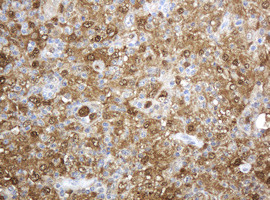 TYMP Antibody in Immunohistochemistry (Paraffin) (IHC (P))