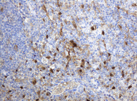 TYMP Antibody in Immunohistochemistry (Paraffin) (IHC (P))