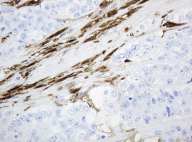 TYMP Antibody in Immunohistochemistry (Paraffin) (IHC (P))