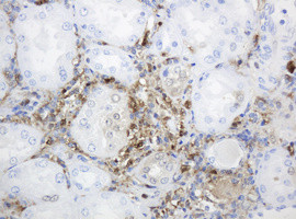 TYMP Antibody in Immunohistochemistry (Paraffin) (IHC (P))