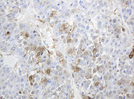 TYMP Antibody in Immunohistochemistry (Paraffin) (IHC (P))