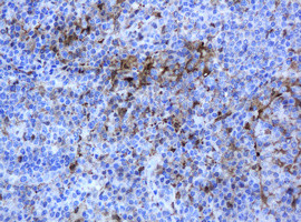 TYMP Antibody in Immunohistochemistry (Paraffin) (IHC (P))