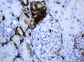 TYMP Antibody in Immunohistochemistry (Paraffin) (IHC (P))