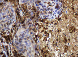 TYMP Antibody in Immunohistochemistry (Paraffin) (IHC (P))