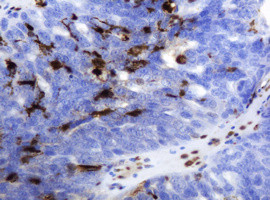 TYMP Antibody in Immunohistochemistry (Paraffin) (IHC (P))