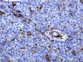 TYMP Antibody in Immunohistochemistry (Paraffin) (IHC (P))