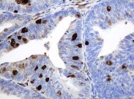 TYMP Antibody in Immunohistochemistry (Paraffin) (IHC (P))