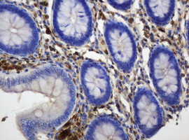 TYMP Antibody in Immunohistochemistry (Paraffin) (IHC (P))