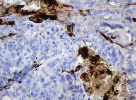 TYMP Antibody in Immunohistochemistry (Paraffin) (IHC (P))