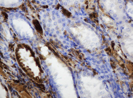 TYMP Antibody in Immunohistochemistry (Paraffin) (IHC (P))