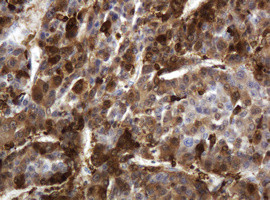 TYMP Antibody in Immunohistochemistry (Paraffin) (IHC (P))