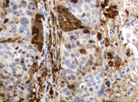 TYMP Antibody in Immunohistochemistry (Paraffin) (IHC (P))