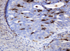 TYMP Antibody in Immunohistochemistry (Paraffin) (IHC (P))