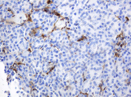 TYMP Antibody in Immunohistochemistry (Paraffin) (IHC (P))