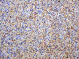 TYMP Antibody in Immunohistochemistry (Paraffin) (IHC (P))