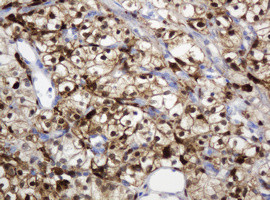 TYMP Antibody in Immunohistochemistry (Paraffin) (IHC (P))