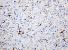 TYMP Antibody in Immunohistochemistry (Paraffin) (IHC (P))