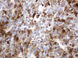 TYMP Antibody in Immunohistochemistry (Paraffin) (IHC (P))