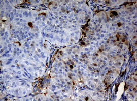 TYMP Antibody in Immunohistochemistry (Paraffin) (IHC (P))