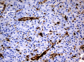 TYMP Antibody in Immunohistochemistry (Paraffin) (IHC (P))