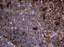 TYMP Antibody in Immunohistochemistry (Paraffin) (IHC (P))