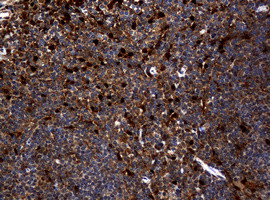 TYMP Antibody in Immunohistochemistry (Paraffin) (IHC (P))