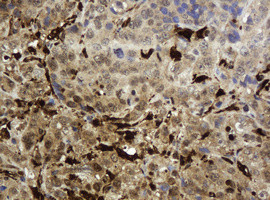 TYMP Antibody in Immunohistochemistry (Paraffin) (IHC (P))