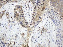 TYMP Antibody in Immunohistochemistry (Paraffin) (IHC (P))