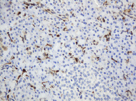 TYMP Antibody in Immunohistochemistry (Paraffin) (IHC (P))