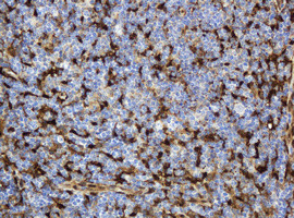 TYMP Antibody in Immunohistochemistry (Paraffin) (IHC (P))