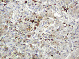 TYMP Antibody in Immunohistochemistry (Paraffin) (IHC (P))