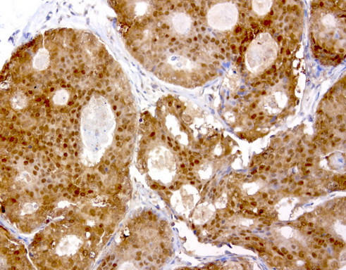 TYMP Antibody in Immunohistochemistry (Paraffin) (IHC (P))