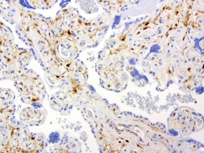 TYMP Antibody in Immunohistochemistry (Paraffin) (IHC (P))