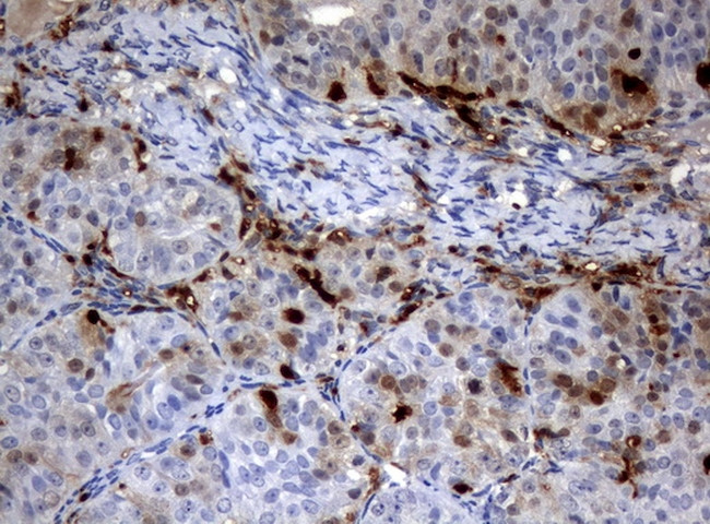 TYMP Antibody in Immunohistochemistry (Paraffin) (IHC (P))