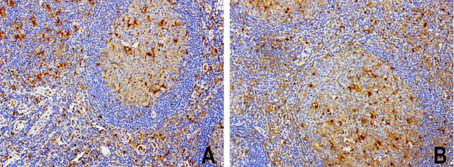 TYMP Antibody in Immunohistochemistry (Paraffin) (IHC (P))