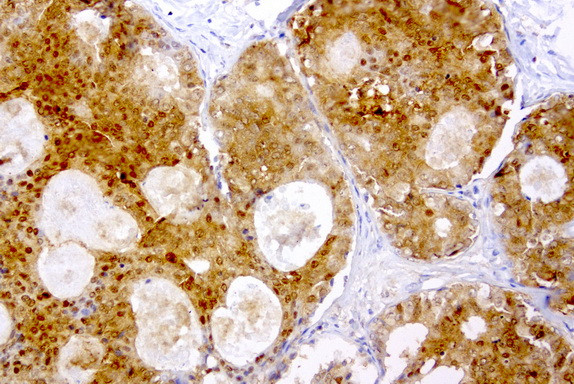 TYMP Antibody in Immunohistochemistry (Paraffin) (IHC (P))