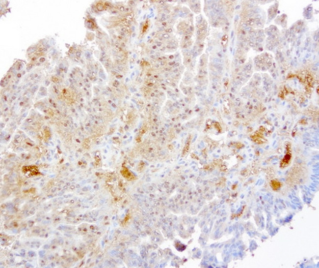 TYMP Antibody in Immunohistochemistry (Paraffin) (IHC (P))