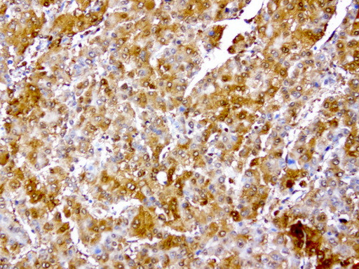 TYMP Antibody in Immunohistochemistry (Paraffin) (IHC (P))