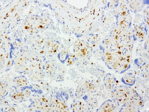 TYMP Antibody in Immunohistochemistry (Paraffin) (IHC (P))