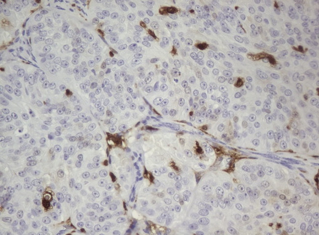 TYMP Antibody in Immunohistochemistry (Paraffin) (IHC (P))