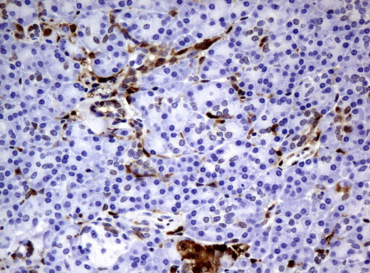 TYMP Antibody in Immunohistochemistry (Paraffin) (IHC (P))