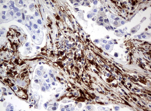 TYMP Antibody in Immunohistochemistry (Paraffin) (IHC (P))