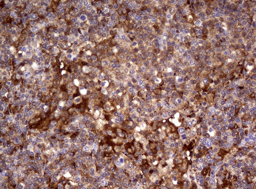 TYMP Antibody in Immunohistochemistry (Paraffin) (IHC (P))