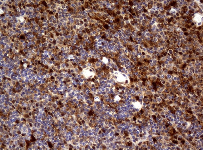 TYMP Antibody in Immunohistochemistry (Paraffin) (IHC (P))