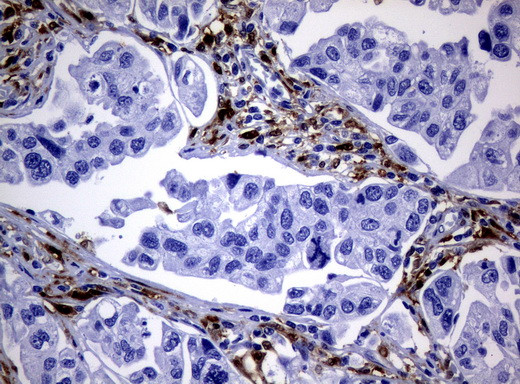 TYMP Antibody in Immunohistochemistry (Paraffin) (IHC (P))